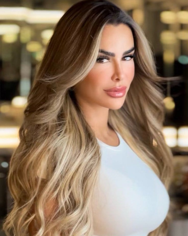 Ninel Conde, botox