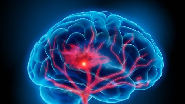 Cerebro. Salud mental