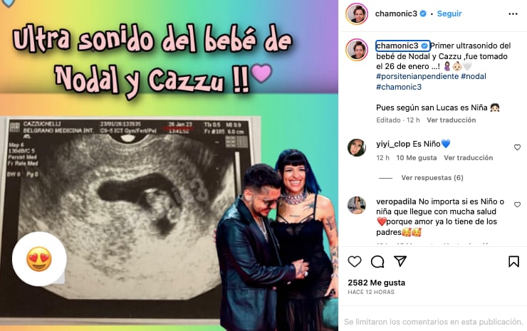 Supuesto ultrasonido realizado a Cazzu