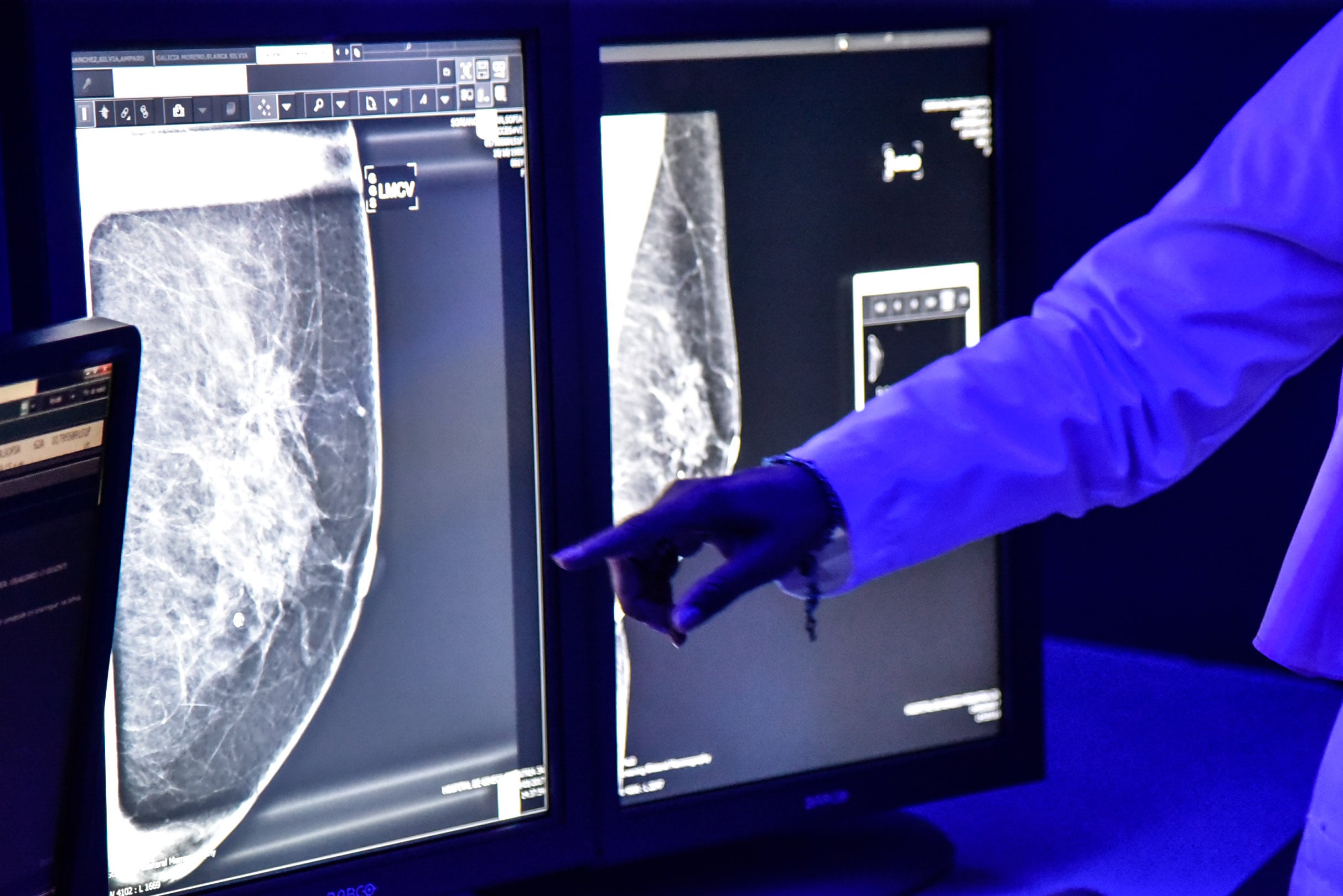 Con la vacuna, Lee Mercker, logró eliminar de su cuerpo las células cancerígenas.
