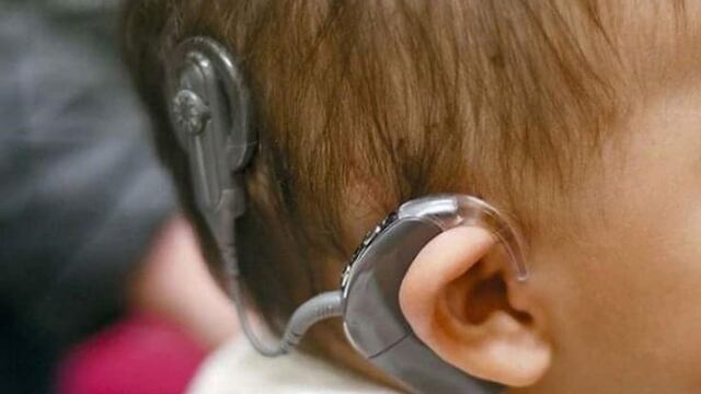 Implantes cocleares para niños