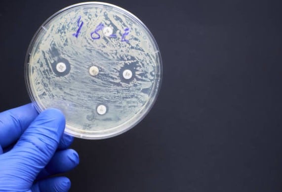 Imagen representativa de la listeria