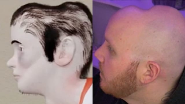 La abolladura en la cabeza en gamers sería el principio de la deformación de su aspecto físico