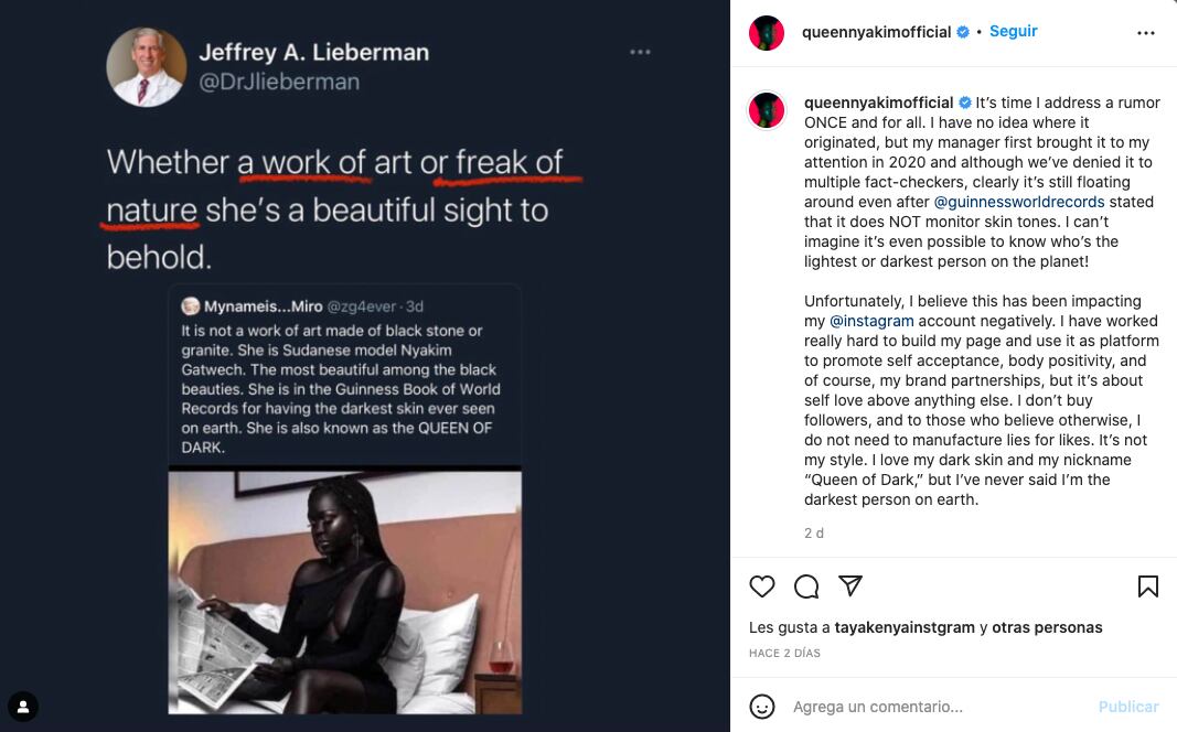 Modelo Nyakim Gatwetch responde a las ofensas de Jeffrey Lieberman