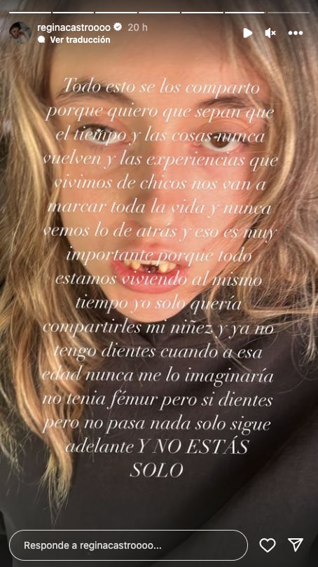 Regina Castro y el accidente a caballo que la dejó sin dientes