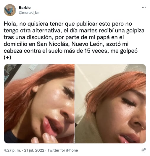 una joven es golpeada por su papá en Nuevo León