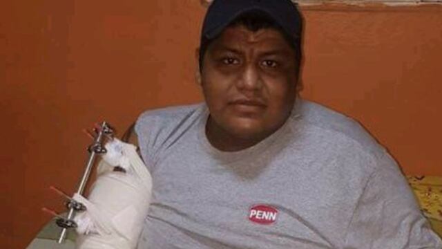 Jorge Ochoa Parra fue víctima de un atentando en 2017; sobrevivió a 9 balazos.