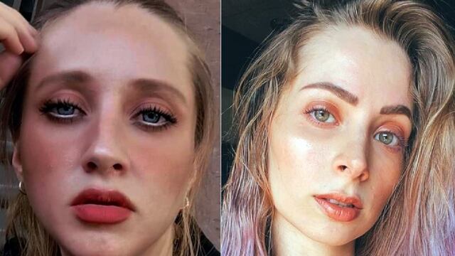 Daffne Hoffman y 'YosStop'