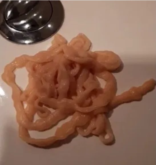 Se saca del trasero tenia de 10 metros