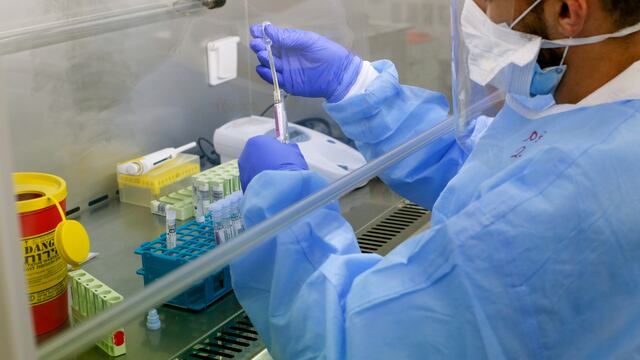 Prueba de laboratorio