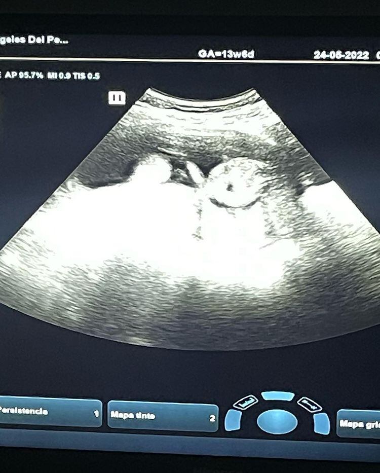 Fernando Santana comparte ultrasonido de su futuro bebé