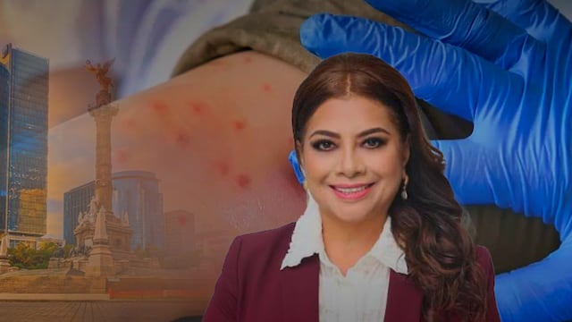 Clara Brugada asegura que el brote de sarampión está controlado en CDMX