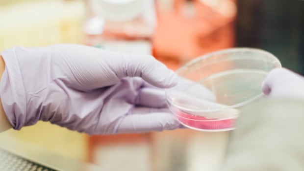 Investigación sobre el cáncer de piel