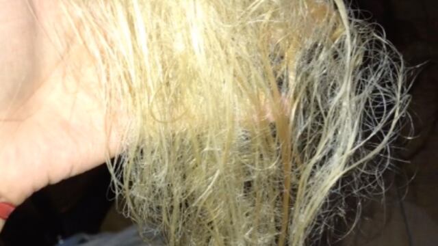 Queda calva antes de su fiesta de XV años