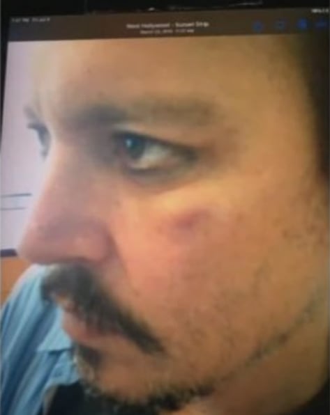 Evidencia de que Amber Heard golpeaba a Jhonny Deep