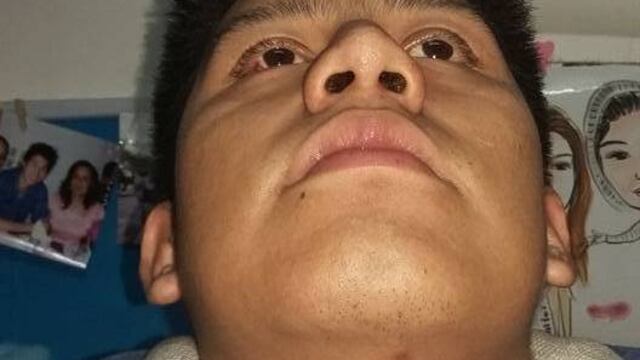 Ataque mexicano en China