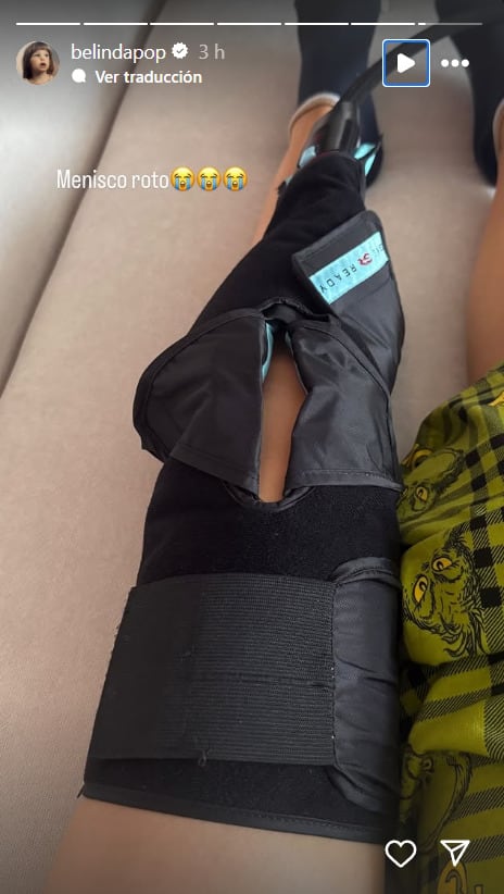 Belinda sufrió una lesión en la rodilla
