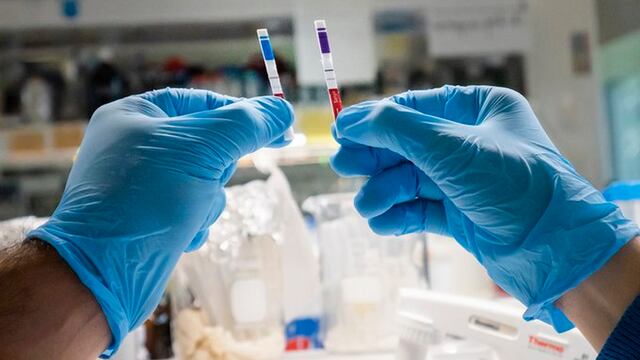 Prueba para Covid-19 en Argentina.