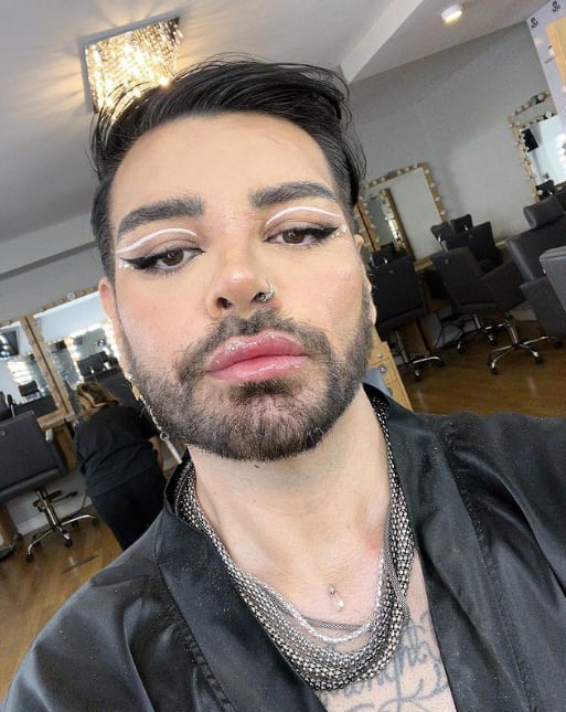 Se operó para parecerse a Ricky Martin