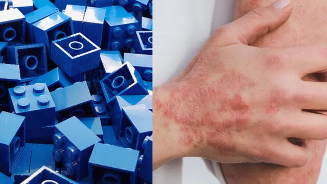 El 28 de enero se celebra el Día de LEGO y el Día contra la Lepra