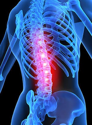 El Método Ovando Sanders contra los problemas de columna vertebral