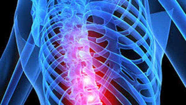 El Método Ovando Sanders contra los problemas de columna vertebral