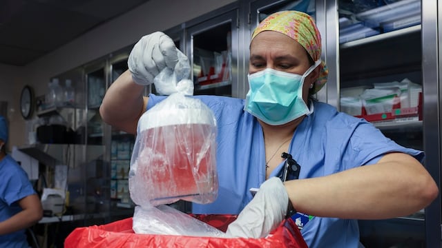 Transplante de riñón de cerdo en Estados Unidos