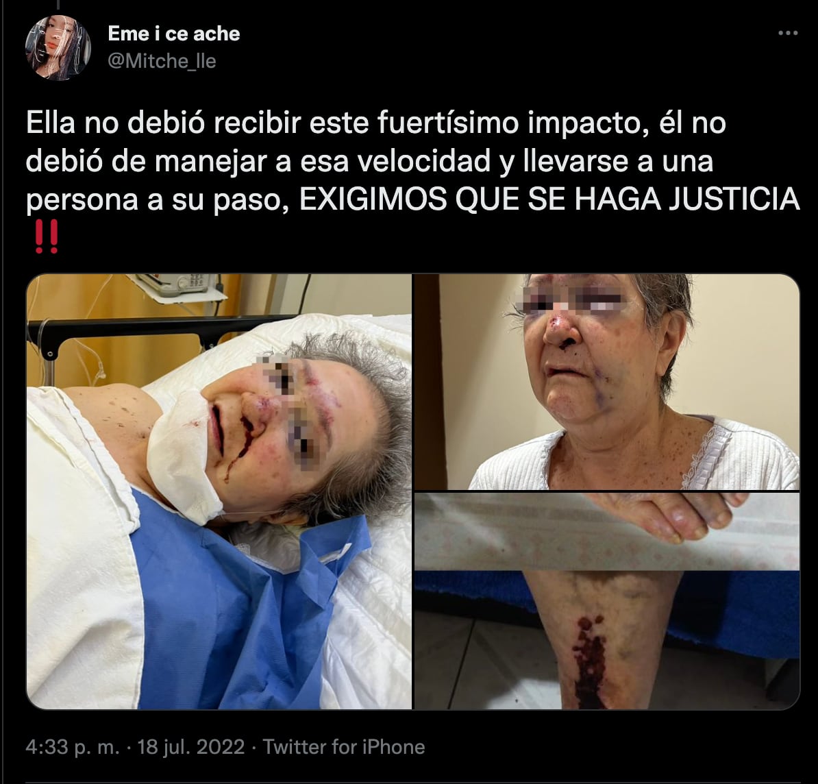 VIDEO: sujeto atropella a mujer de la tercera edad en CDMX; familiares exigen justicia