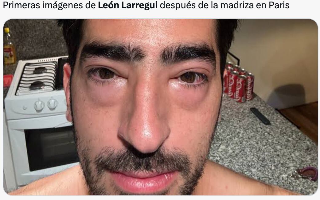 Memes de León Larregui golpeado en París