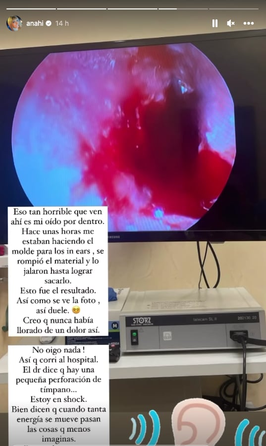 Anahí tuvo un fatal incidente que le perforó el tímpano “No oigo nada”