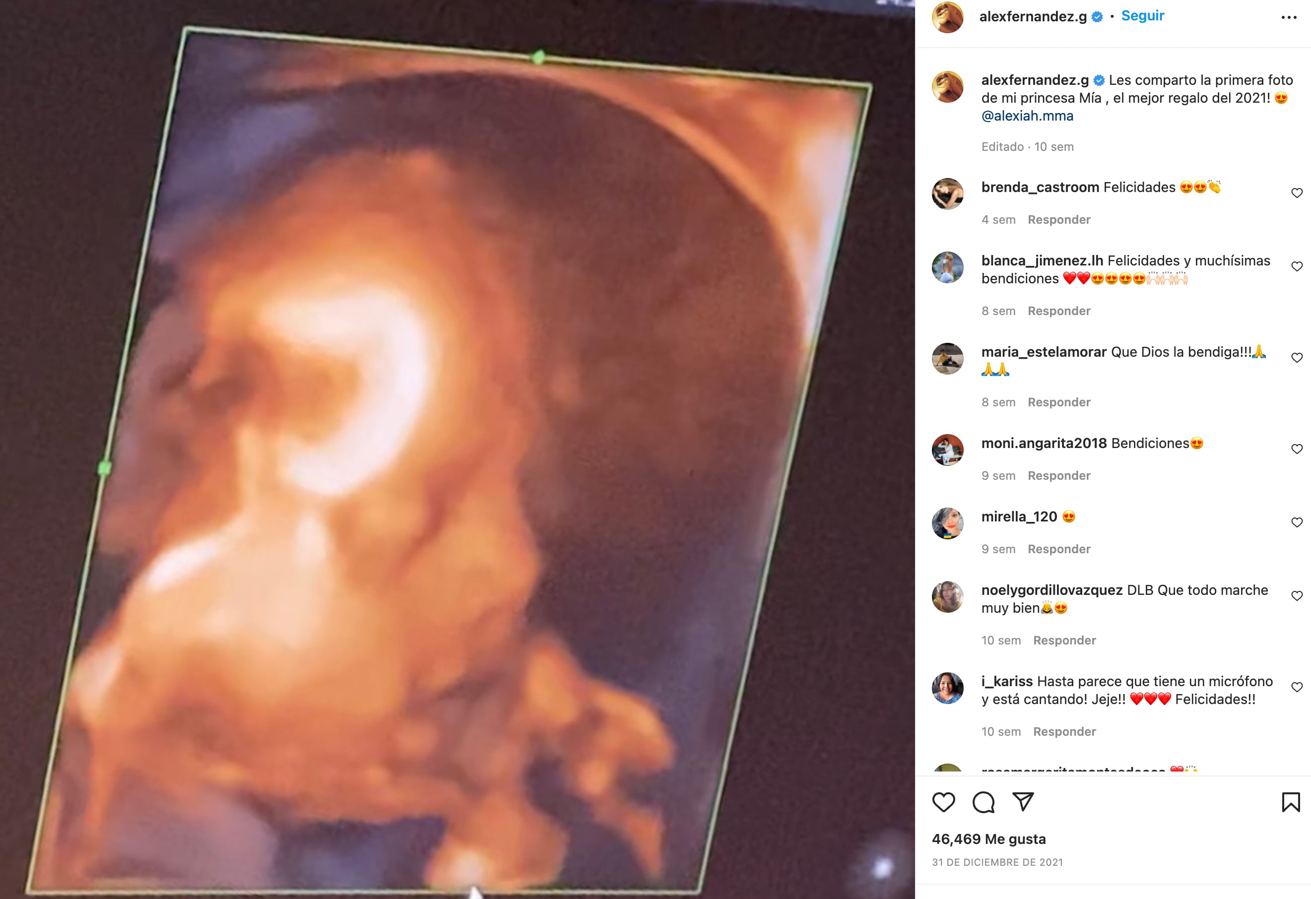 Ecografía de Mía Fernández