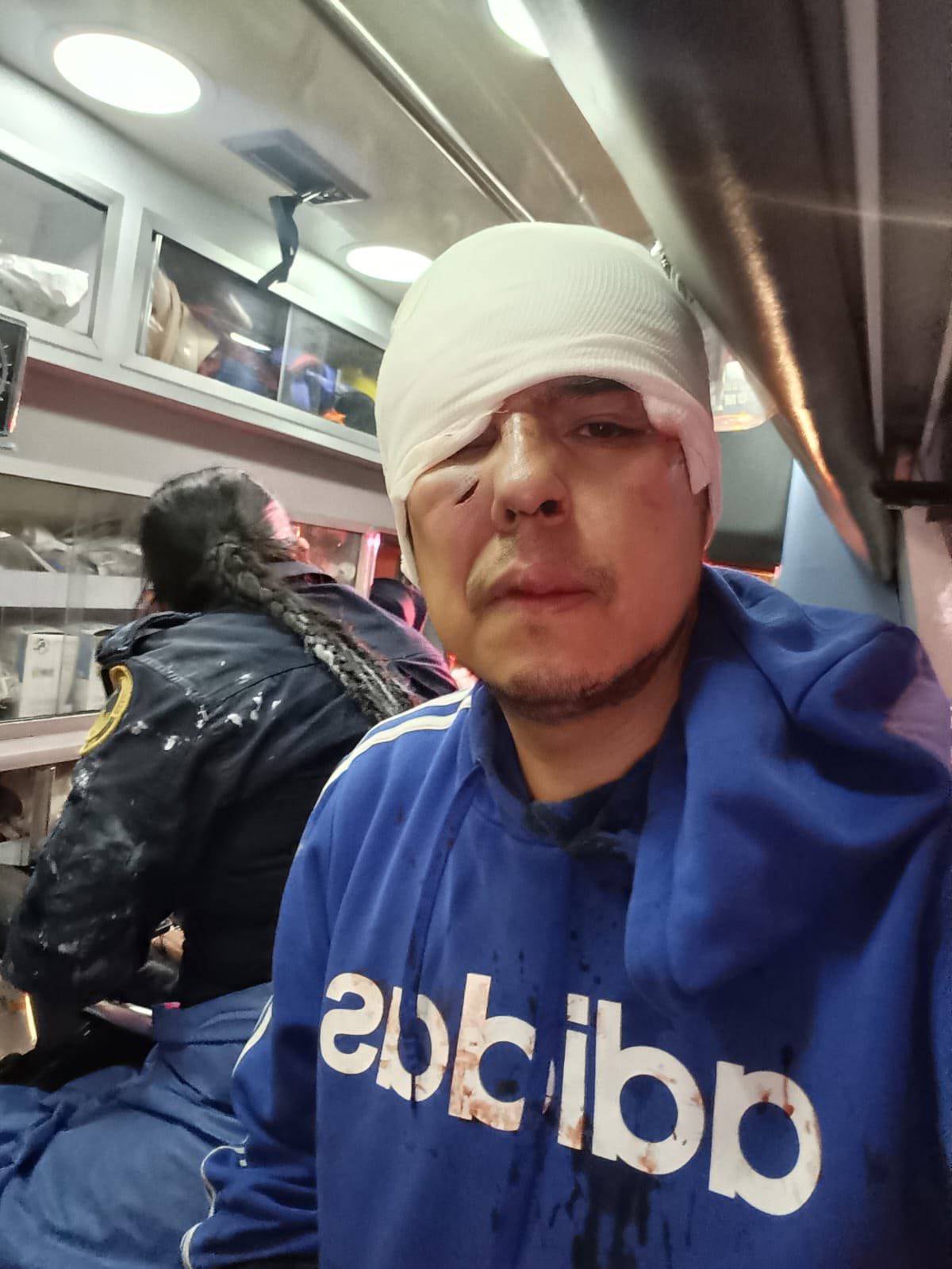 Nicolás Corte, periodista agredido durante marcha 2 de octubre CDMX