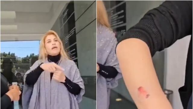 Surge Lady Mordidas en Tlalnepantla