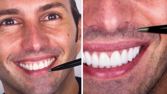 Poncho de Nigris no pagó sus carillas, acusa doctor