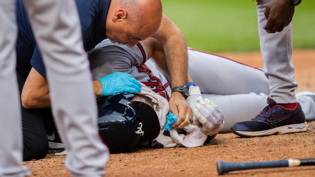 Culberson sufrió múltiples fracturas en el rostro