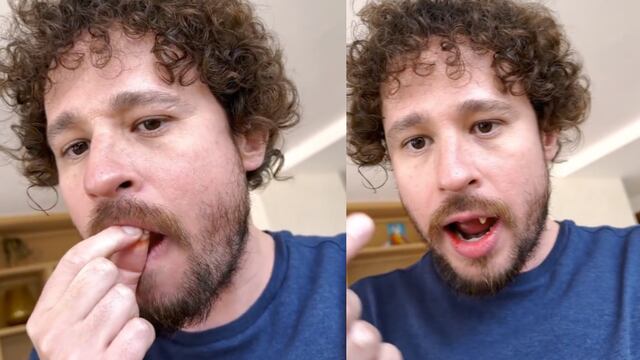 A Luisito Comunica se le caen los dientes en un en vivo.