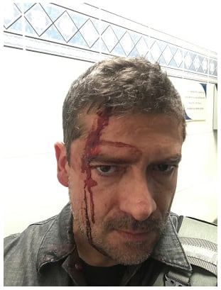 Agreden presuntos narcomenudistas al periodista Humberto Padgett en CU