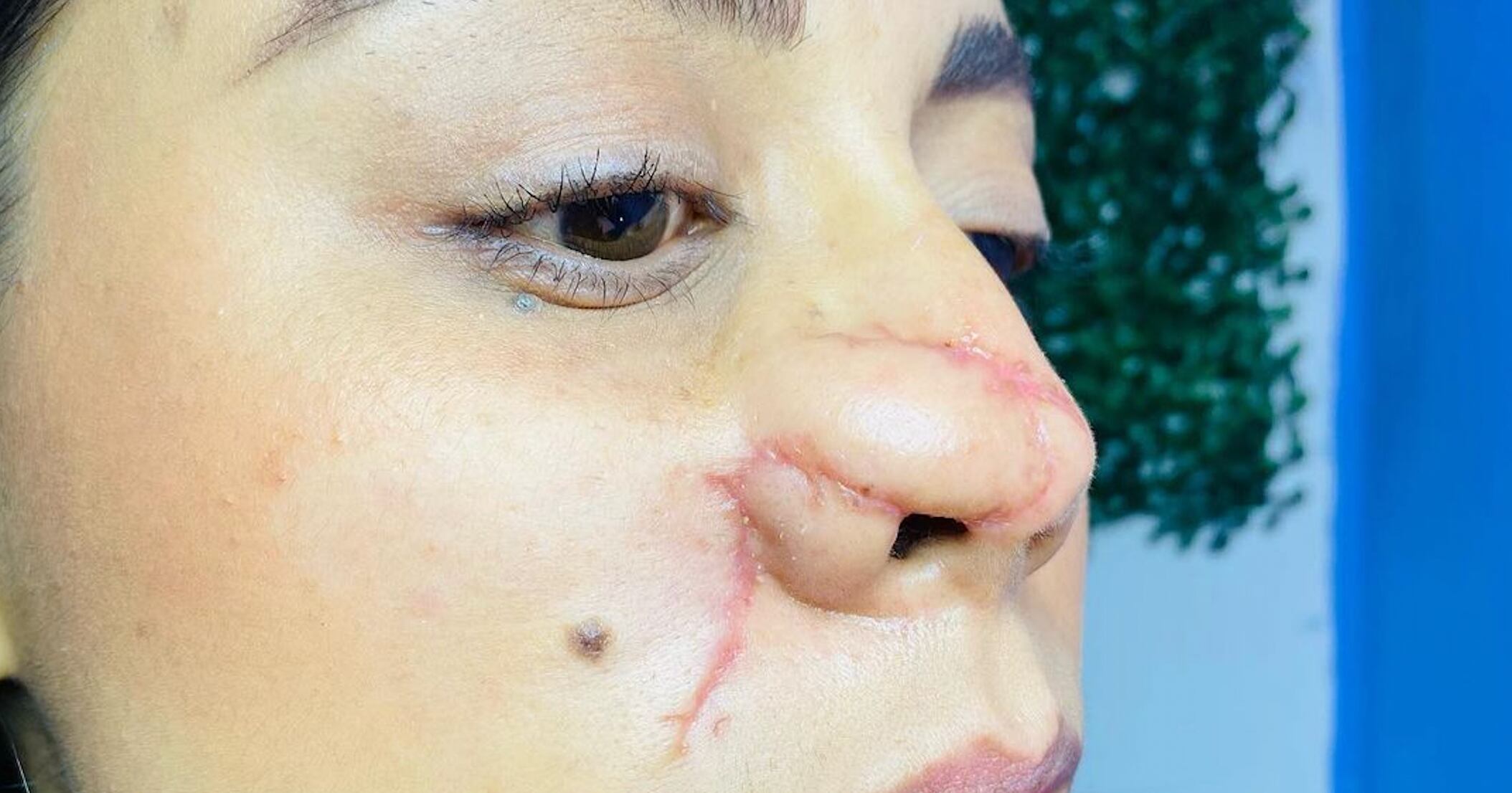 Jazmín, víctima del ataque feminicida de Roberto de Anda en Tlalixcoyan, Veracruz