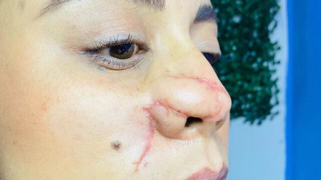 Jazmín, víctima del ataque feminicida de Roberto de Anda en Tlalixcoyan, Veracruz