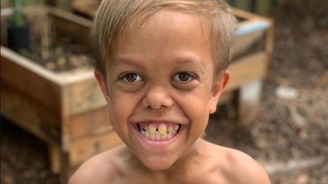 Quaden, el niño que pidió morir tras ser víctima de acoso.