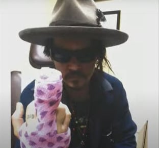Johnny Depp con vendaje