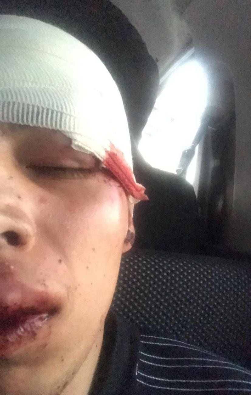 Así quedo el rostro del fan del Club Tigres golpeado brutalmente por seguidores del Club León.