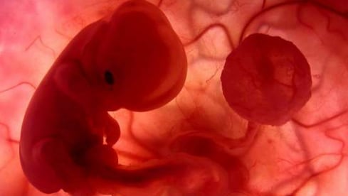 Quienes defienden mantener la ley anti-aborto vigente y promueven esta cruzada contra la libertad individual se asumen moralmente superiores; se erigen como almas piadosas.