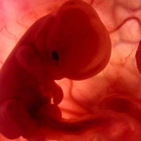 Aborto: la vieja receta que ya no necesitamos