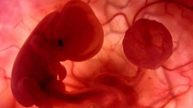 Quienes defienden mantener la ley anti-aborto vigente y promueven esta cruzada contra la libertad individual se asumen moralmente superiores; se erigen como almas piadosas.