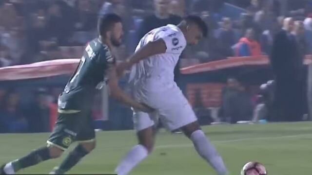 Acá el embarazoso acto.