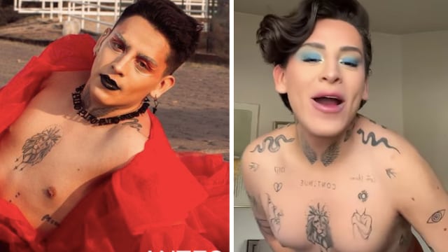 ¿Kunno se inyecta el pecho?