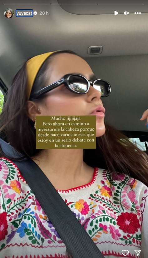 Yuya confiesa que se está quedando pelona