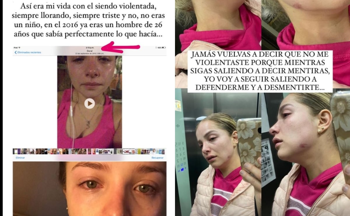 Sandra Itzel comparte fotos donde se muestra con agresiones físicas