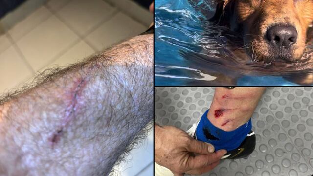 David Faitelson compara su herida con la de Igor Lichnovsky